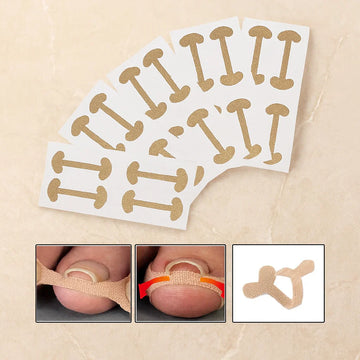 Toenail Correction Strips 20 Pcs