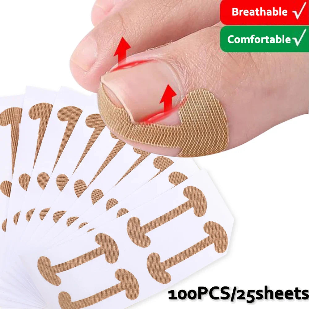 Toenail Correction Strips 20 Pcs